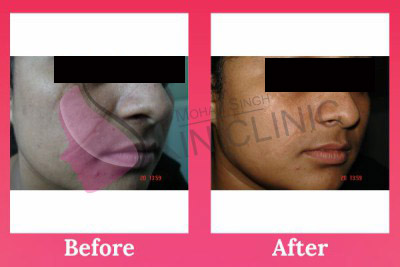 laser & cosmetic dermatology