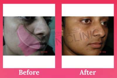 laser & cosmetic dermatology