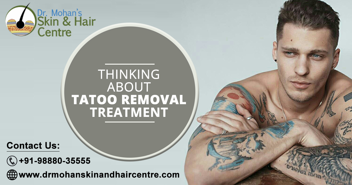 FAQ on Tattoo Removal Treatment in India