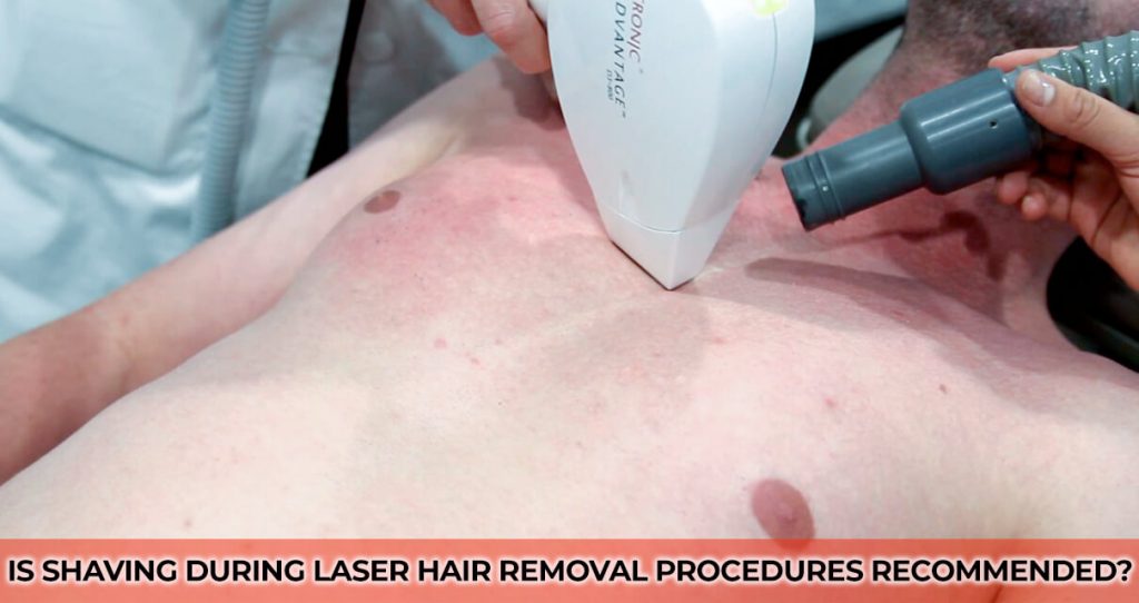 Is Shaving during Laser Hair Removal Procedures Recommended?