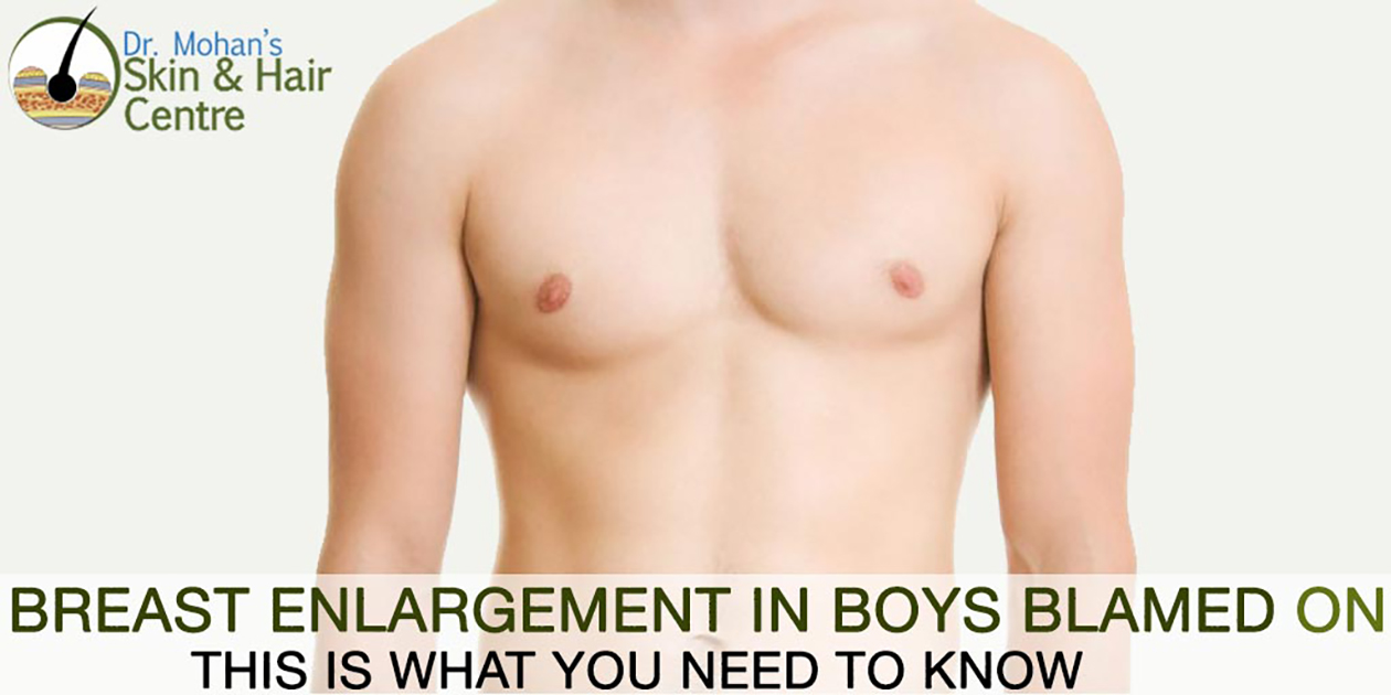 Breast Enlargement in Boys Blamed on Cosmetics. This is What You Need To Know