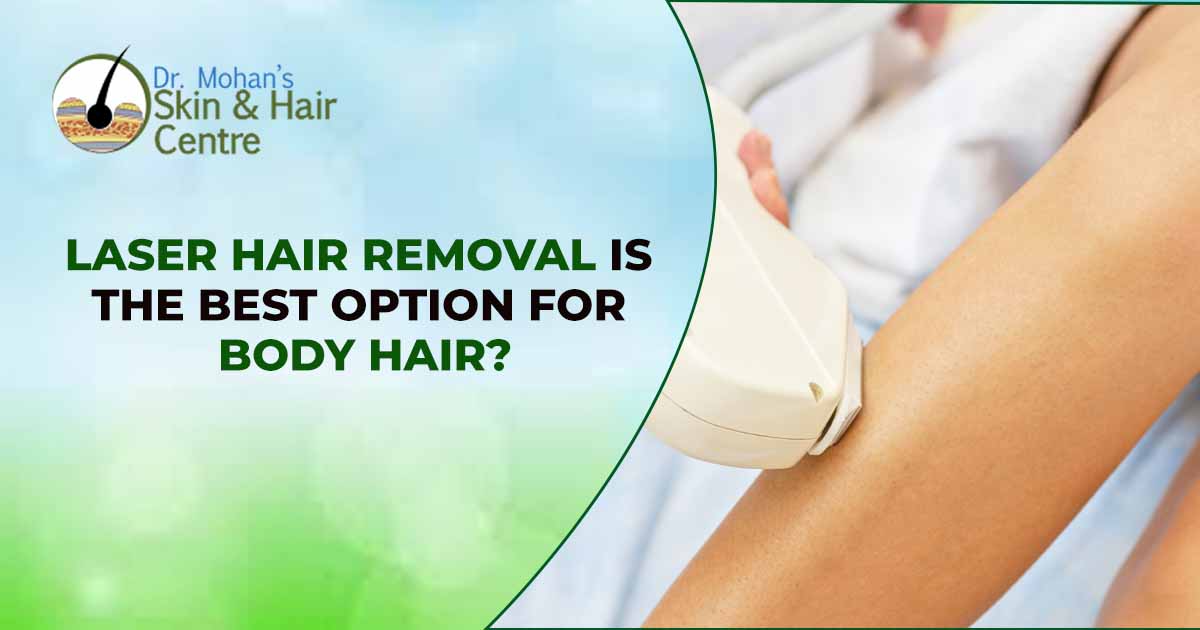 Laser Hair Removal Is The Best Option For Body Hair?