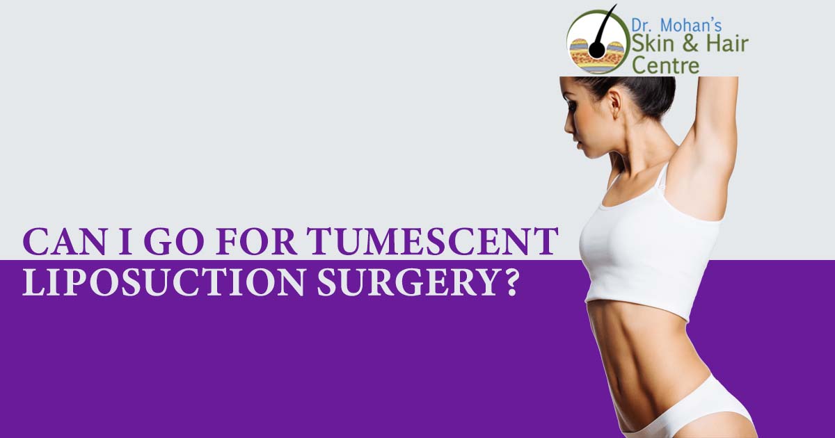 Can I Go For Tumescent Liposuction Surgery?