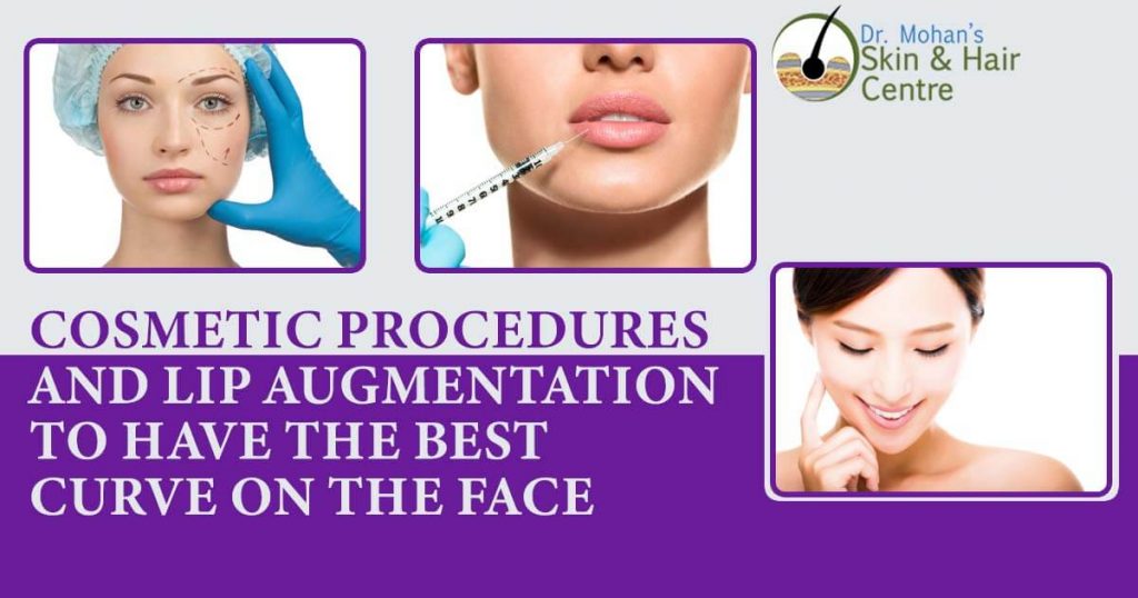 Cosmetic Procedures And Lip Augmentation To Have The Best Curve On The Face