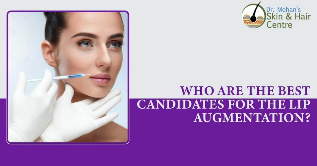 Who are the best candidates for the lip augmentation