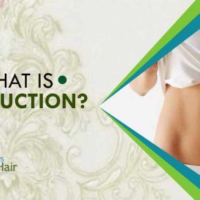 What is liposuction?