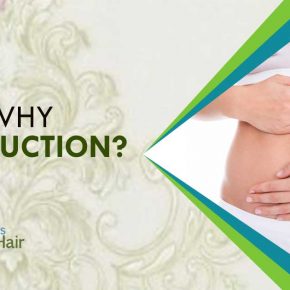 Why liposuction?