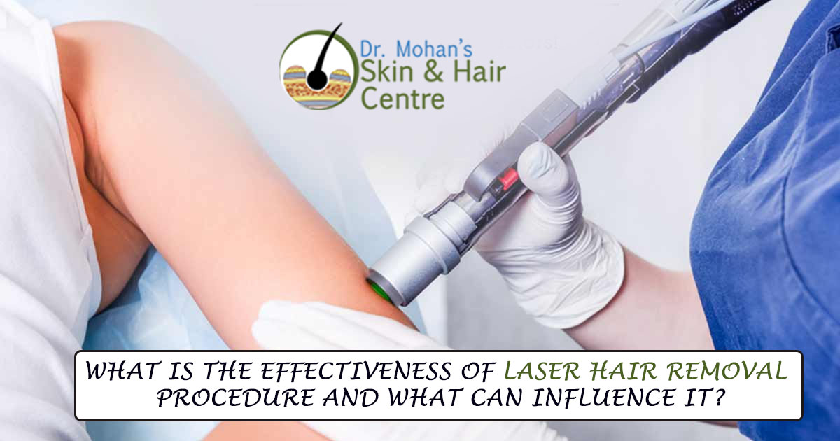 Laser Hair Removal in Moga - Full Body & Facial Laser Hair Removal Treatment