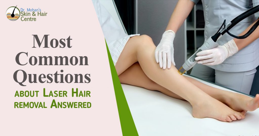 Most Common questions about Laser Hair removal Answered