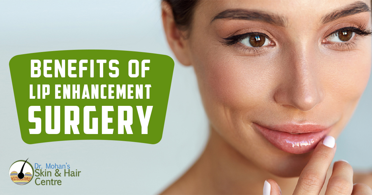 Benefits of Lip Enhancement Surgery