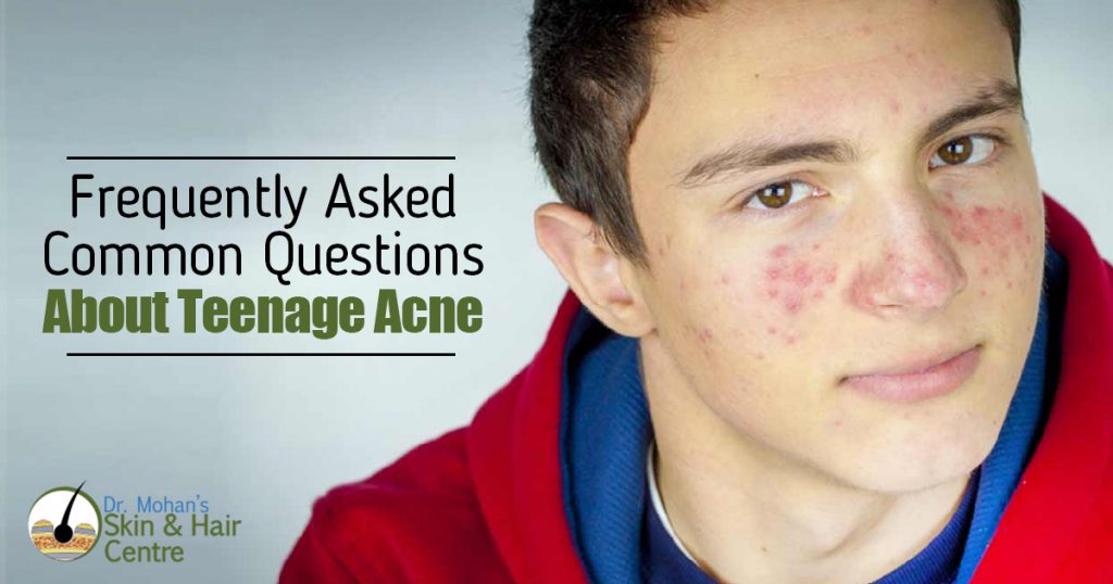 Frequently Asked Common Questions About teenage Acne