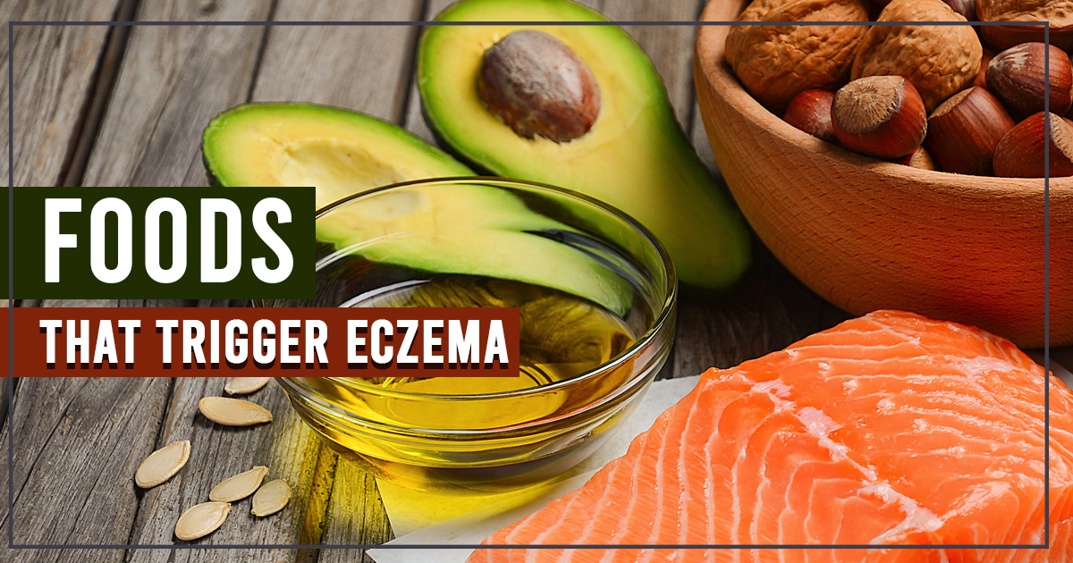 Foods that trigger Eczema