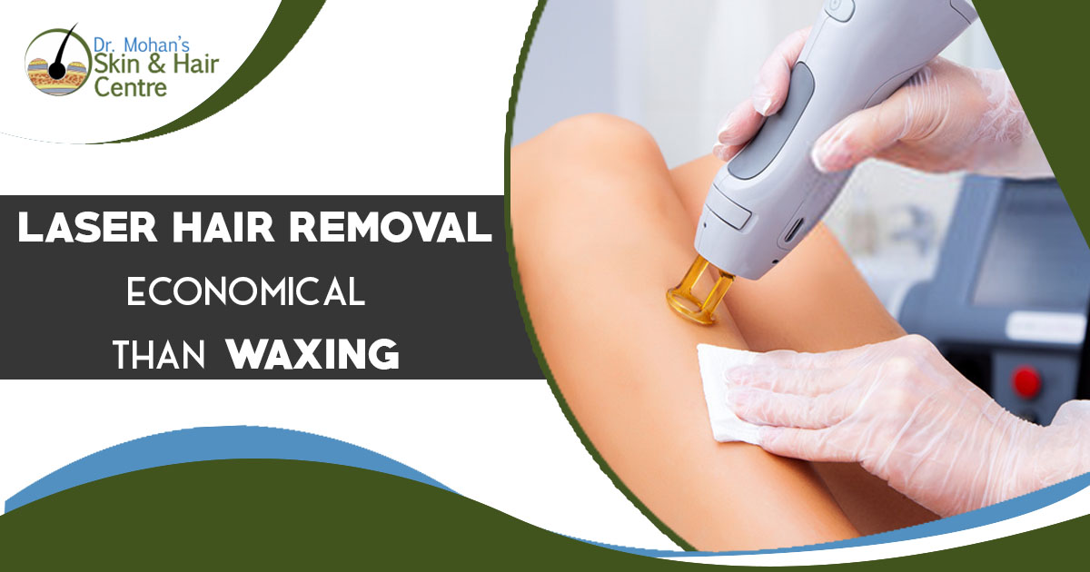 Laser hair removal economical than waxing