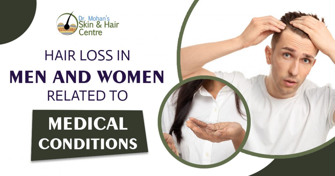 Hair loss in men and women related to medical conditions