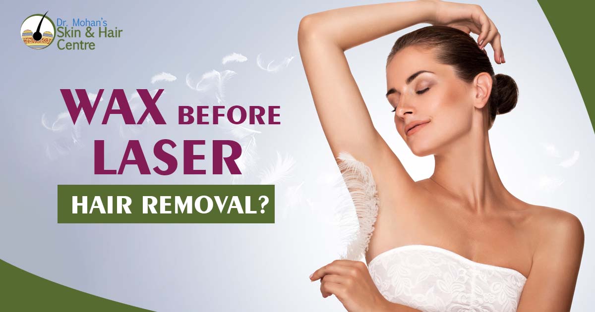 Wax Before laser hair removal