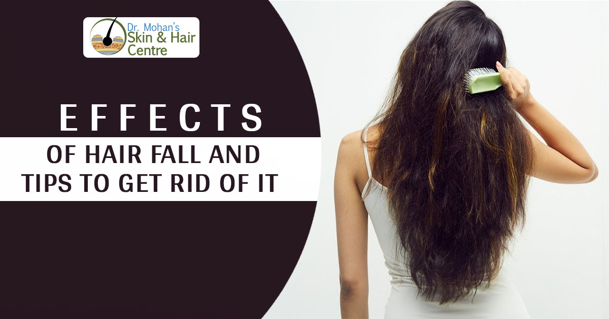 Effects of Hair fall and tips to get rid of it