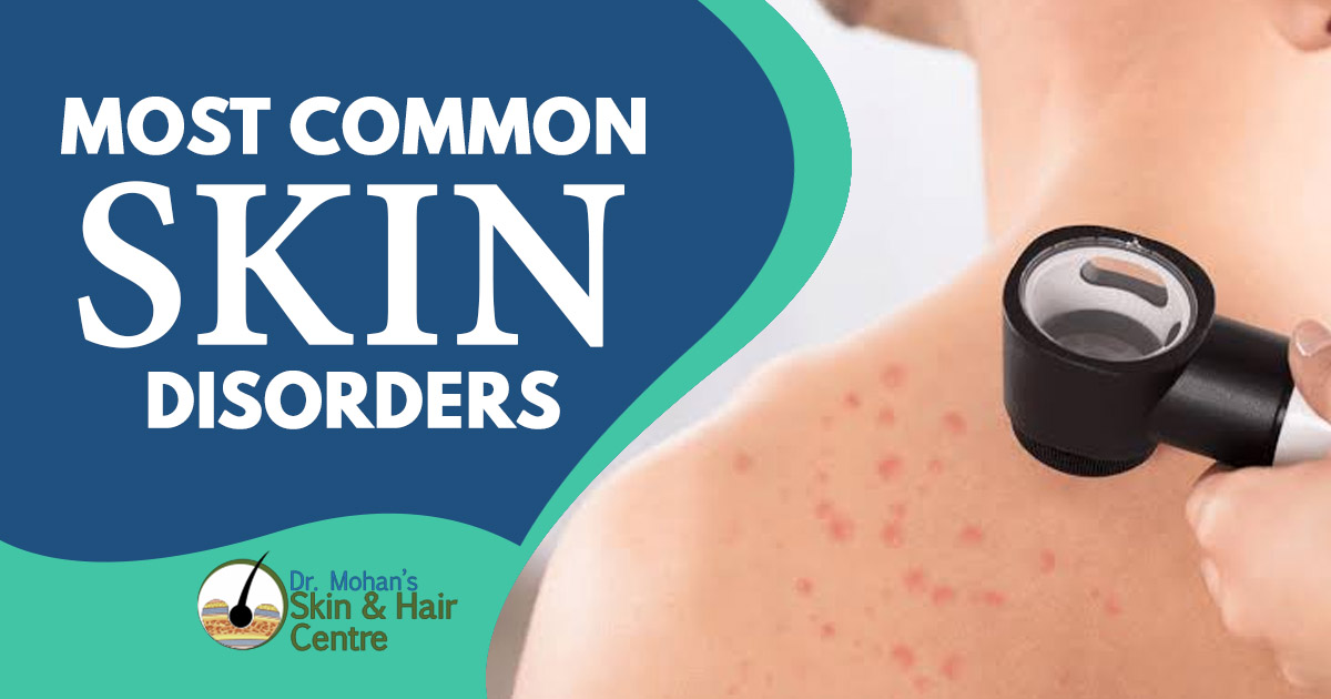 Most common skin disorders