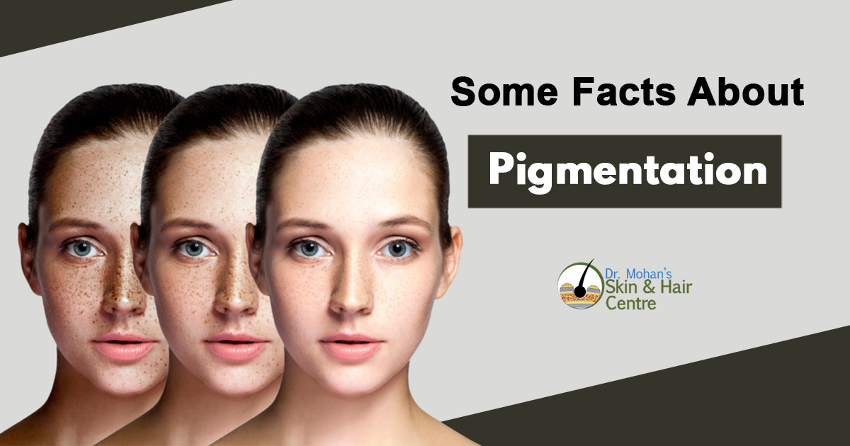 Some facts about Pigmentation