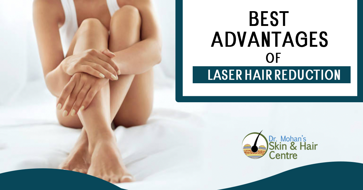Best advantages of laser hair reduction