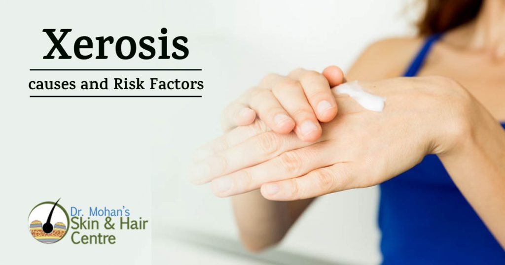 Xerosis causes and Risk Factors